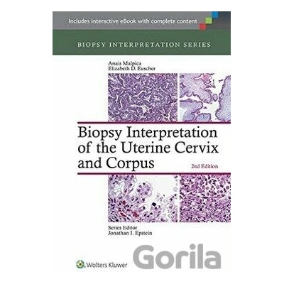 Biopsy Interpretation of the Uterine Cervix and Corpus - Anais Malpica