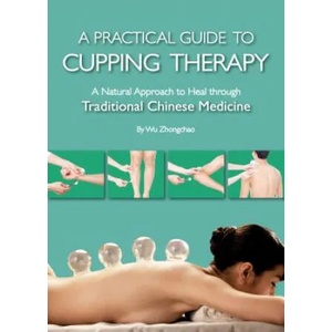 Practical Guide to Cupping Therapy | Zhongchao Wu (ISBN: 9781602200319)