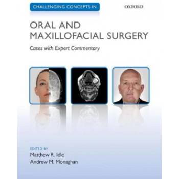 Challenging Concepts in Oral and Maxillofacial Surgery | Matthew Idle