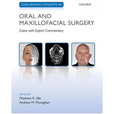 Challenging Concepts in Oral and Maxillofacial Surgery | Matthew Idle