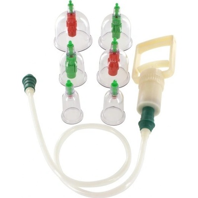 Suction cupping set