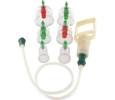 Suction cupping set