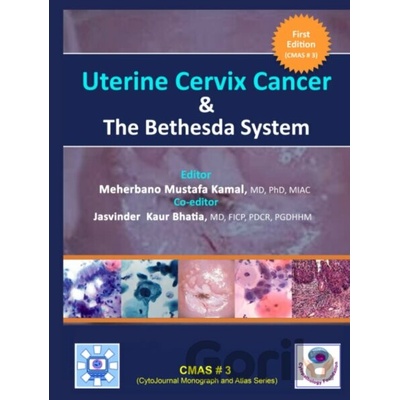 Uterine Cervix Cancer The Bethesda System - Meherbano Mustafa Kamal