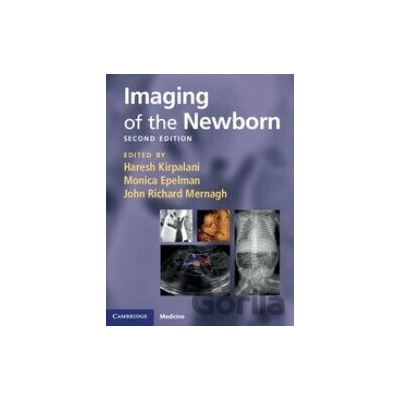 Imaging of the Newborn