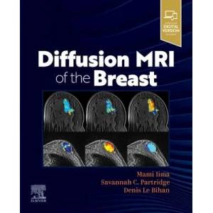 Diffusion MRI of the Breast | Mami Iima, Savannah Partridge, Denis Le Bihan (ISBN: 9780323797023)