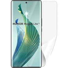 Ochranná fólie ScreenShield HONOR Magic 5 lite 5G - displej