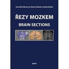 Řezy mozkem