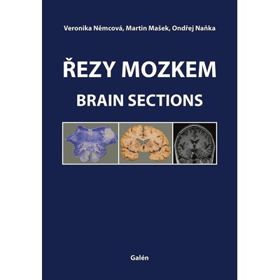 Řezy mozkem