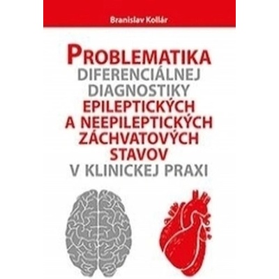 Problematika diferenciálnej diagnostiky epileptických a neepileptických záchvatových stavov v klinic