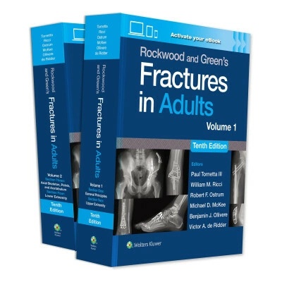 Rockwood and Green's Fractures in Adults: Print + eBook with Multimedia