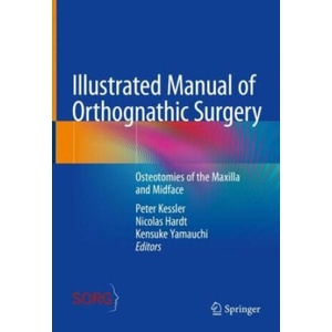Illustrated Manual of Orthognathic Surgery (ISBN: 9783031498688)