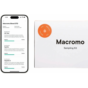 Macromo Domáci Krvný test – STD
