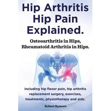 Hip Arthritis, Hip Pain Explained. Osteoarthritis in Hips, Rheumatoid Arthritis in Hips. Including Hip Arthritis Surgery, Hip Flexor Pain, Exercises, Rymore Robert