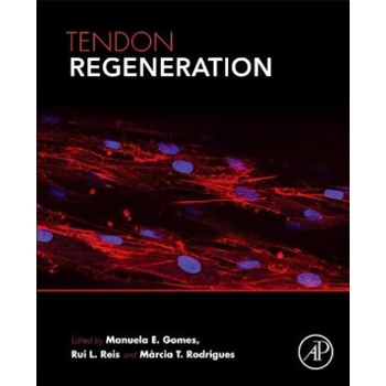 Tendon Regeneration