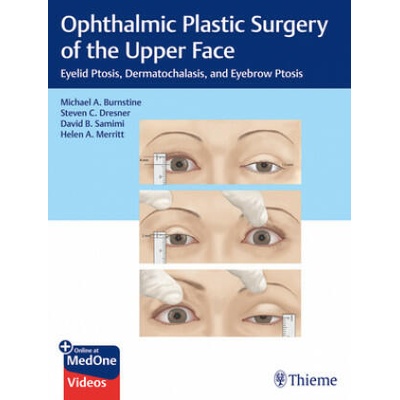 Ophthalmic Plastic Surgery of the Upper Face | Michael Burnstine, Steven Dresner, David Samimi, Helen Merritt