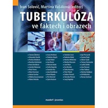 Tuberkulóza ve faktech i obrazech