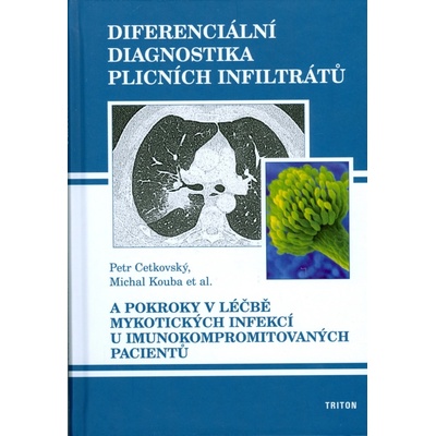 Diferenciální diagnostika plicních infiltrátů - Petr Cetkovský, Michal Kouba a kol.