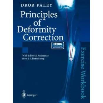 Image 1 of Principles of Deformity Correction | Dror Paley, J. E. Herzenberg