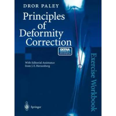 Principles of Deformity Correction | Dror Paley, J. E. Herzenberg