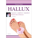 Hallux - Carsten Stark