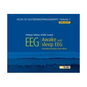 Atlas of Electroencephalography -- Volume 1 | Dr Philippe Gelisse, Dr Arielle Crespel (ISBN: 9782742015900)