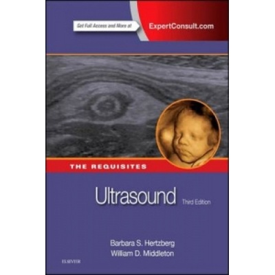 Ultrasound