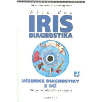 Iris diagnostika
