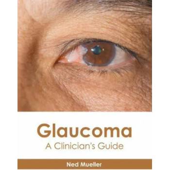 Image 1 of Glaucoma: A Clinician's Guide | Ned Mueller