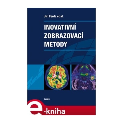 Inovativní zobrazovací metody - Jiří Ferda
