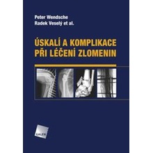 Úskalí a komplikace při léčení zlomenin - Peter Wendsche, Radek Veselý