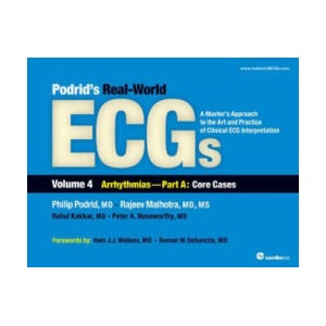 Podrid's Real-World ECGs | Philip Podrid (ISBN: 9781935395027)