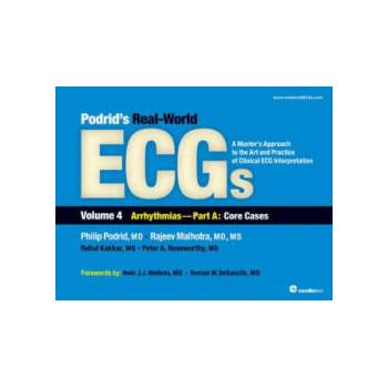 Image 1 of Podrid's Real-World ECGs | Philip Podrid
