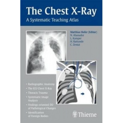 Chest X-Ray Hofer Matthias