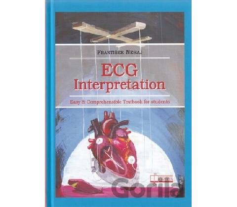 ECG - Interpretation