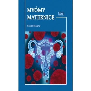 Myómy maternice