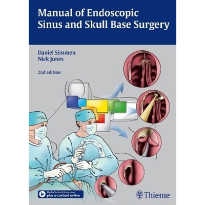Manual of Endoscopic Sinus Surgery - Simmen, Daniel