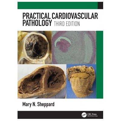 Practical Cardiovascular Pathology - Sheppard Mary N.