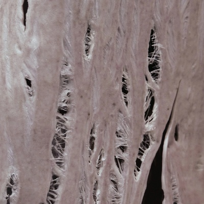 Cobrah - Torn Limited Clear Vinyl [LP]