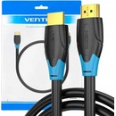 Vention AACBK
