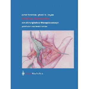 Morbus Dupuytren | Peter Brenner, Ghazi M. Rayan, H. Millesi, J. Gratzer (ISBN: 9783709173923)