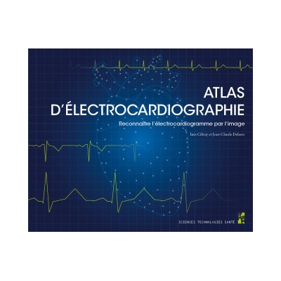 Atlas d’électrocardiographie