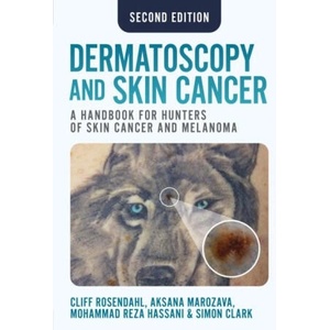 Dermatoscopy and Skin Cancer, second edition (2025)