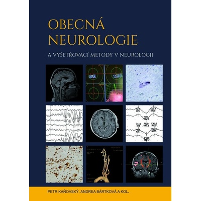 Obecná neurologie a vyšetřovací metody v neurologii - Petr Kaňovský, Andrea Bártková