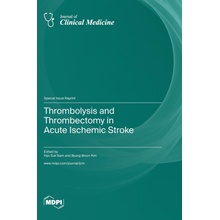 Thrombolysis and Thrombectomy in Acute Ischemic Stroke