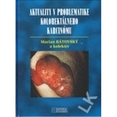 Bátovský Marian - Aktuality v problematike kolorektálneho karcinómu