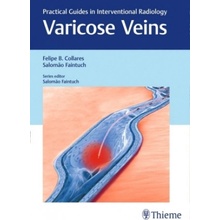 Varicose Veins: Practical Guides in Interventional Radiology