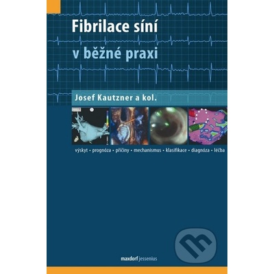 Fibrilace síní v běžné praxi