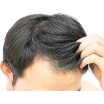 Alpecin Coffein Shampoo C1 Black Edition 250 ml