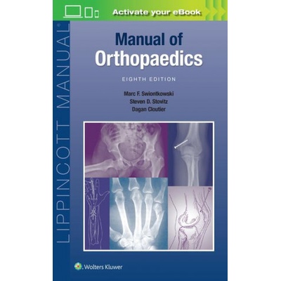 Manual of Orthopaedics | Marc F. Swiontkowski