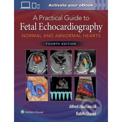 A Practical Guide to Fetal Echocardiography - Alfred Z. Abuhamad